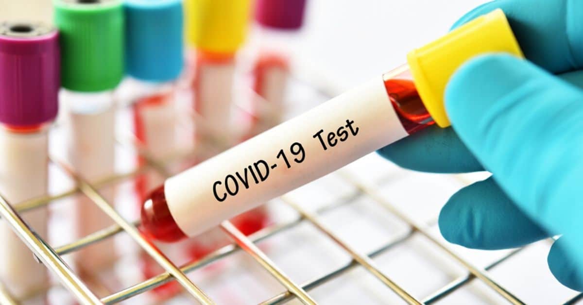 New CPT Code for Coronavirus Tests