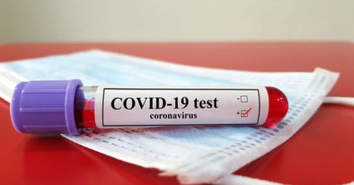 COVID-19 Testing Codes