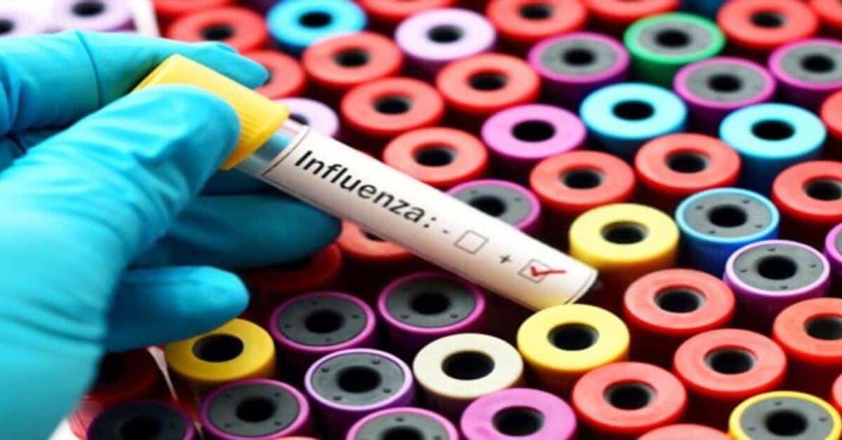 ICD-10 Coding Tips for Influenza